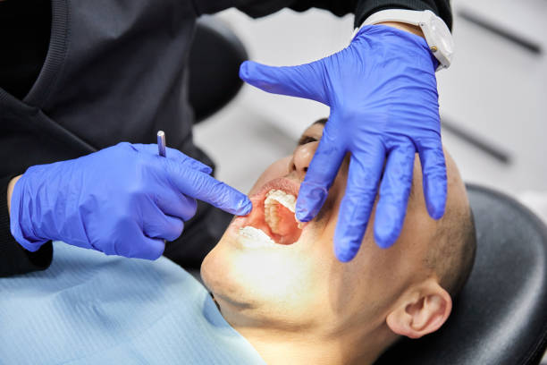 Best Emergency Treatment for Dental Infections or Abscesses in Barrington Hls, IL